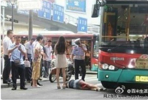 过马路玩手机 深圳女子被车撞倒失右腿