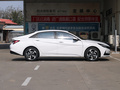 伊兰特 1.5LLUX尊贵版2021款